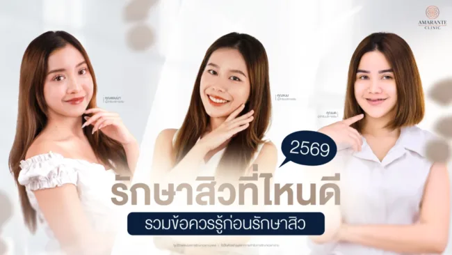 รักษาสิวที่ไหนดีปี และข้อควรรู้ก่อนเลือกรักษาสิว