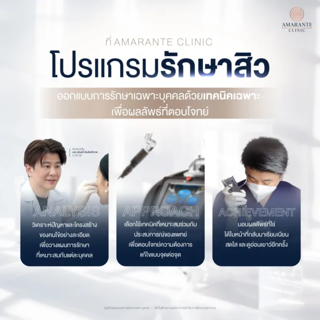 รักษาสิว ที่ไหนดี