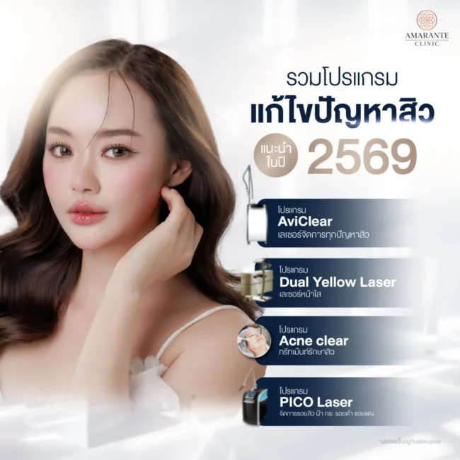 รักษาสิวยังไงดี มีแบบไหนบ้าง