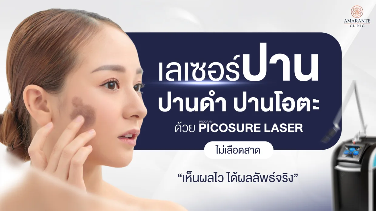 เลเซอร์ปาน ปานดำ ปานโอตะด้วย Picosure Laser