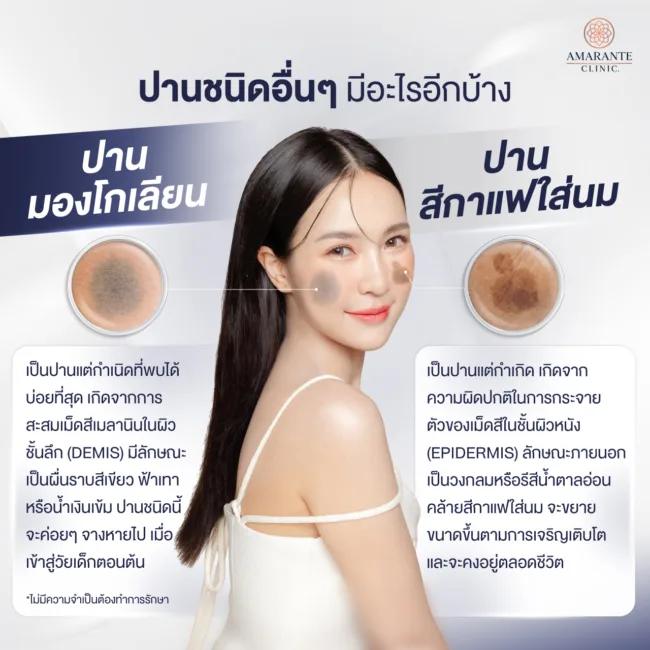 ปานชนิดอื่นๆ มีอะไรอีกบ้าง