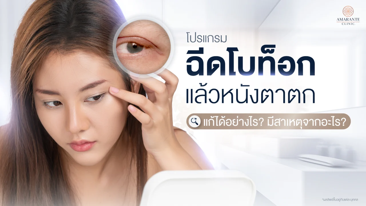 ฉีดโบท็อกแล้วหนังตาตก เกิดจากอะไร? แก้ไขอย่างไร?