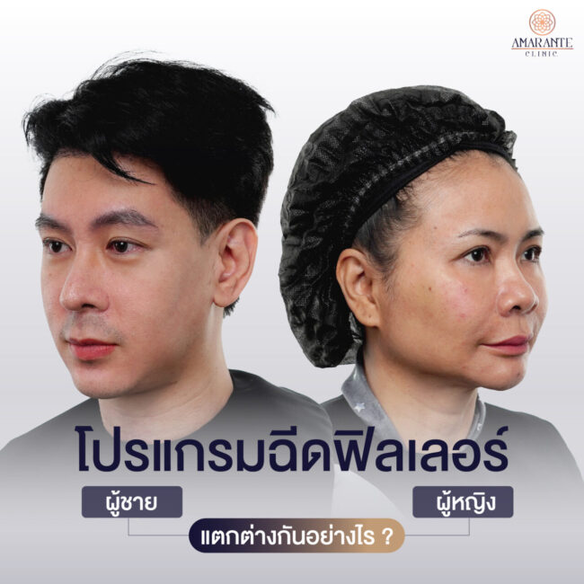 ภาพประกอบของหัวเรื่อง ฉีดฟิลเลอร์ ผู้ชายกับผู้หญิงแตกต่างกันอย่างไร โดยในภาพจะมีหน้าขอผลลัพธ์ของผู้ชายกับผู้หญิงหลังฉีดฟิลเลอร์ให้ดู