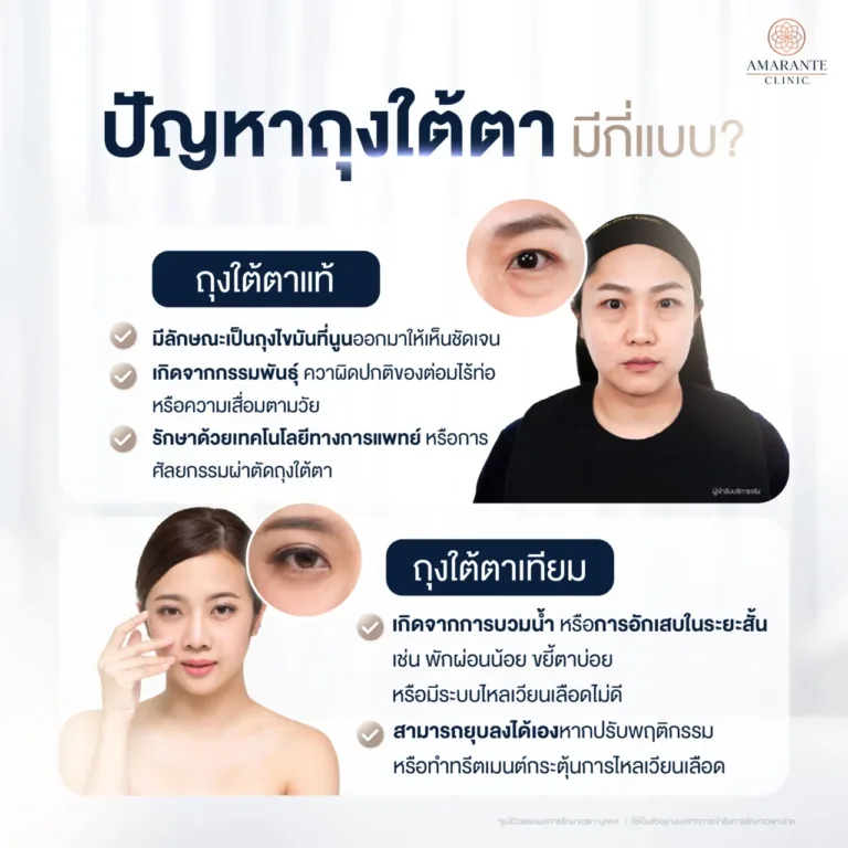 ปัญหาถุงใต้ตามีกี่แบบ ?