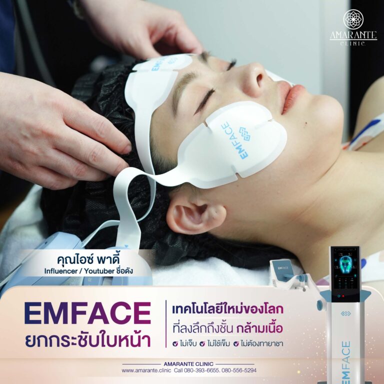 รีวิว emface คุณไอซ์