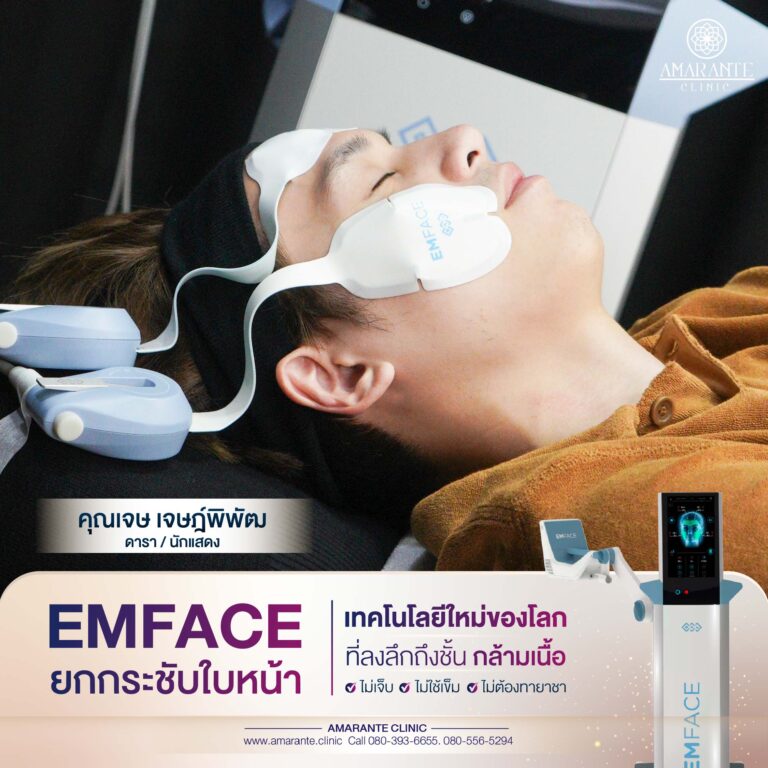 รีวิว emface คุณเจษ