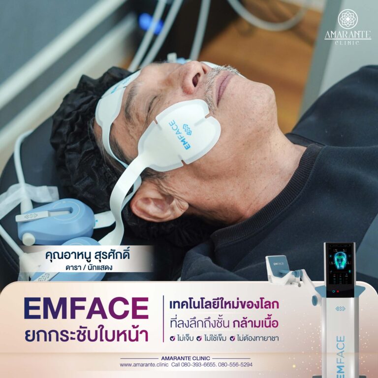 รีวิว emface อาหนู