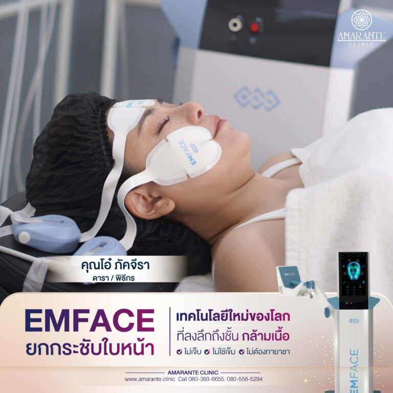 รีวิว emface คุณโอ๋