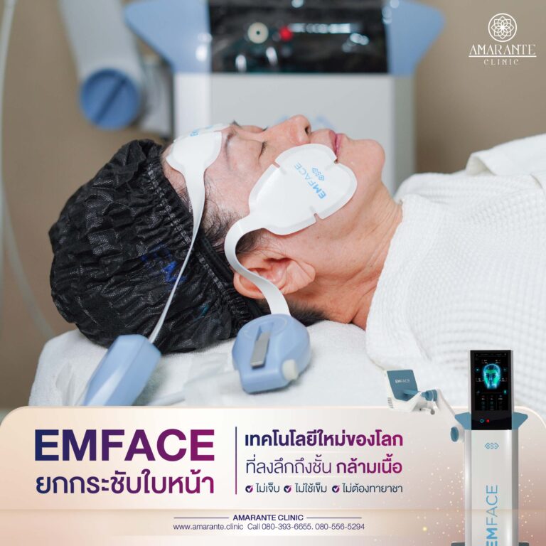 รีวิว emface