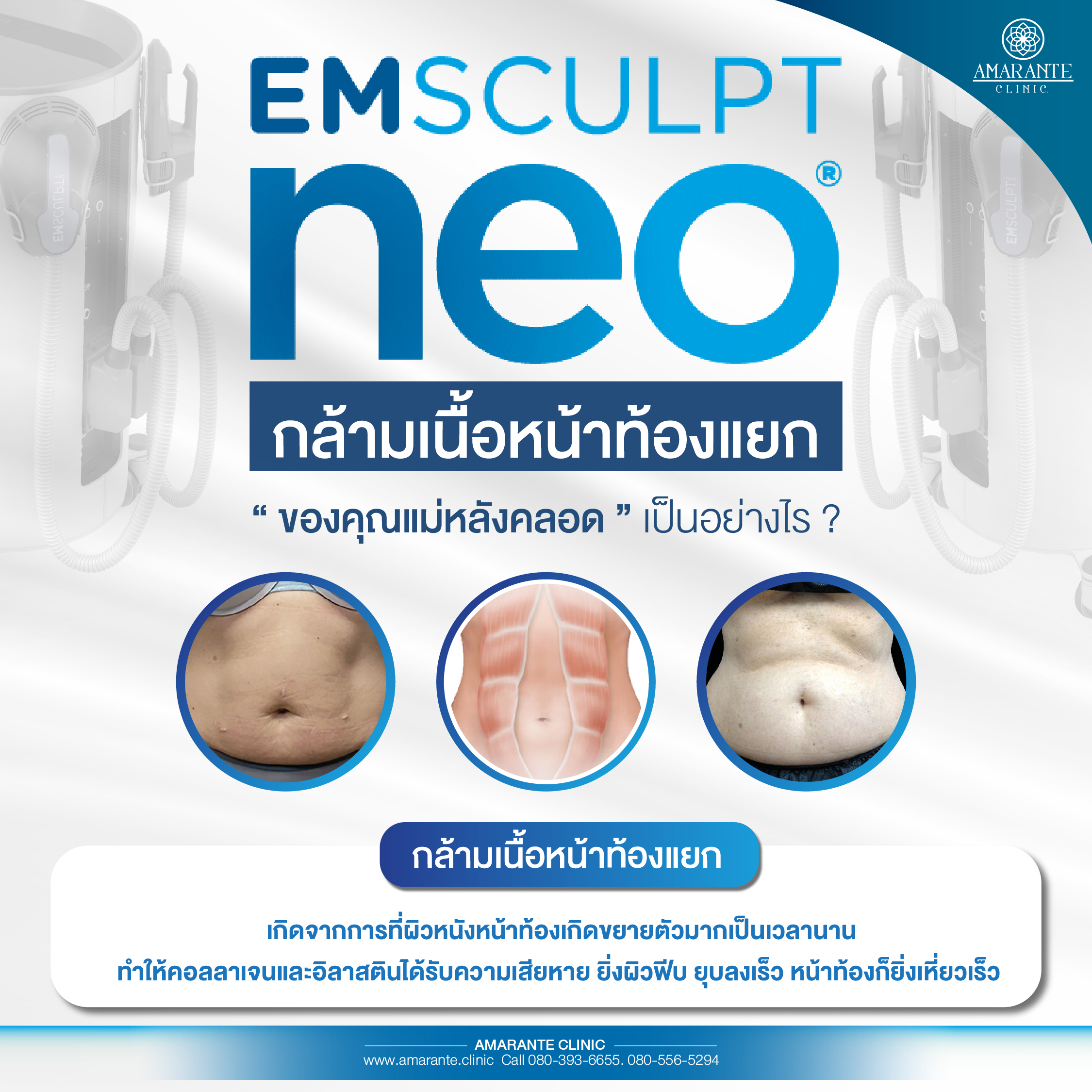 ท้องย้วยหลังคลอด emsculpt neo
