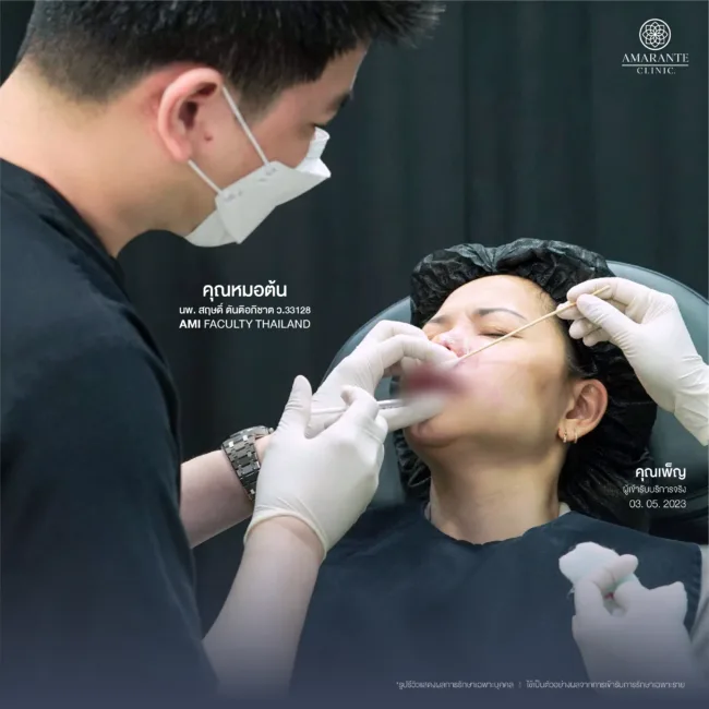 แก้ไขฟิลเลอร์ปลอมที่ไปฉีดหมอกระเป๋ากับคุณหมอต้น ที่Amarante Clinic