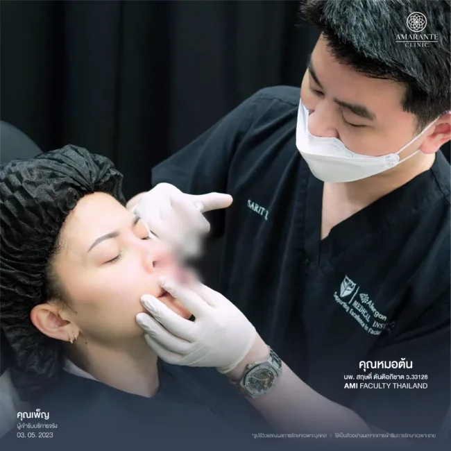 แก้ไขฟิลเลอร์ปลอม กับคุณหมอต้น