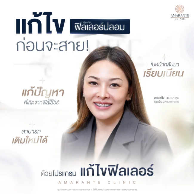 โปรแกรมแก้ไขฟิลเลอร์