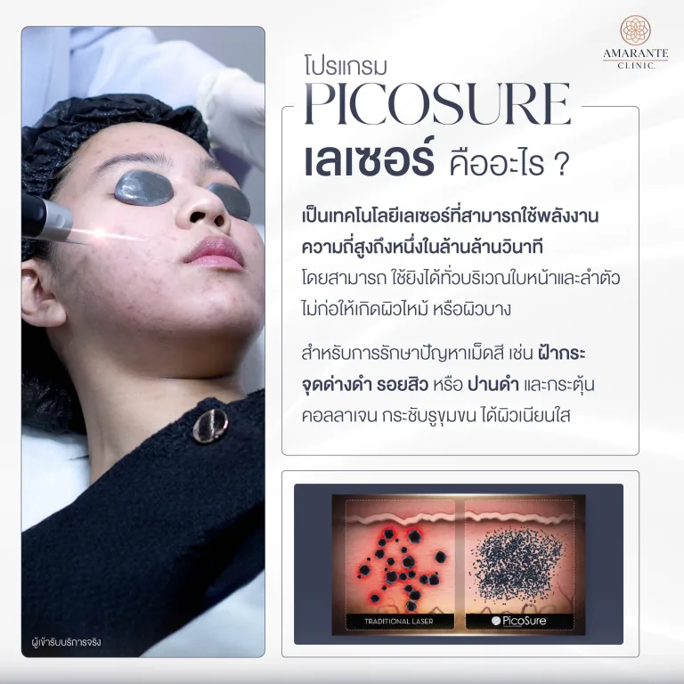 Picosure Laser คืออะไร