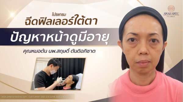 ฉีดฟิลเลอร์ใต้ตา, ฟิลเลอร์ใต้ตา รีวิว