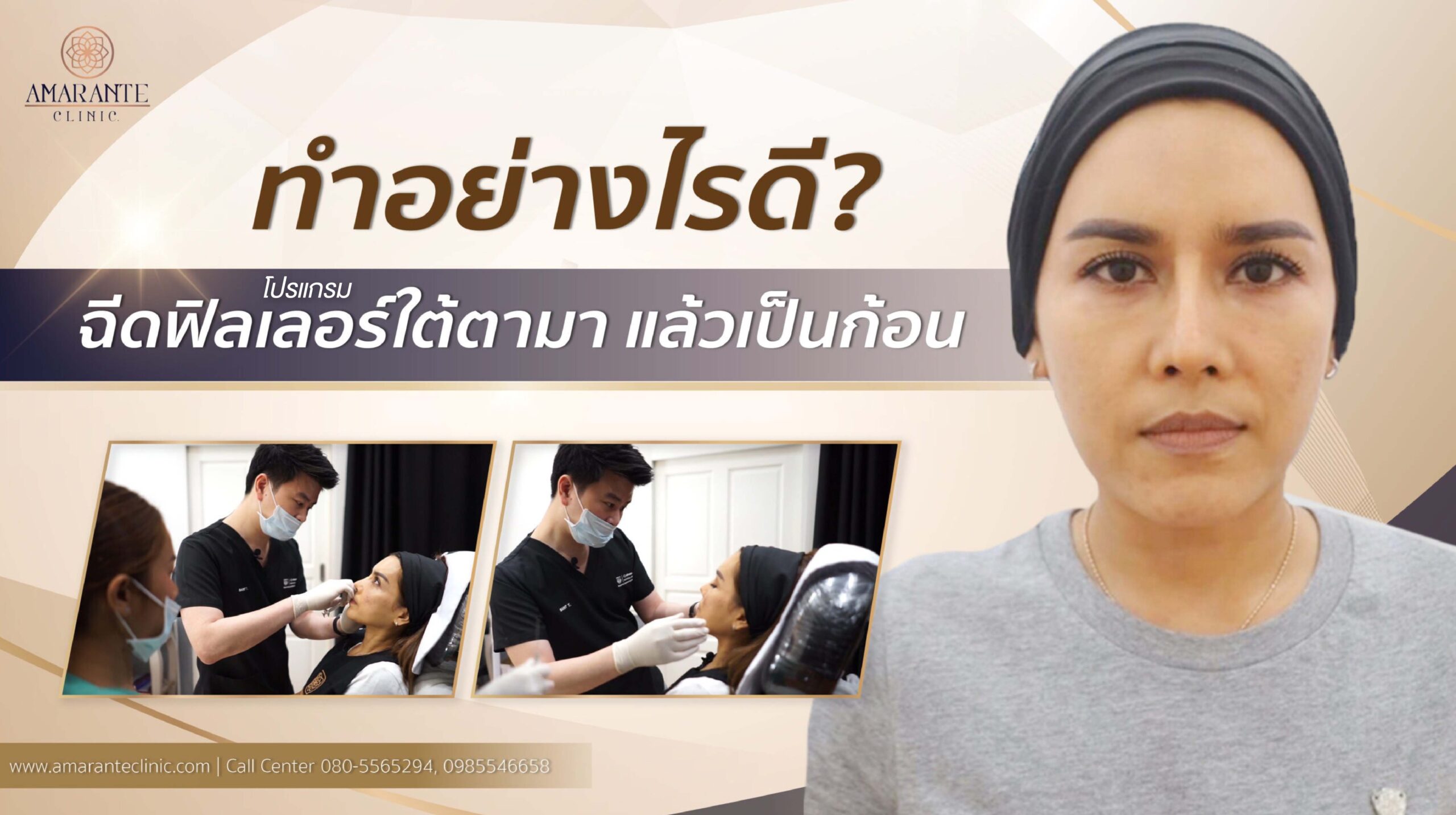 ฉีดฟิลเลอร์ใต้ตา แล้วเป็นก้อน, ใต้ตาเป็นก้อน