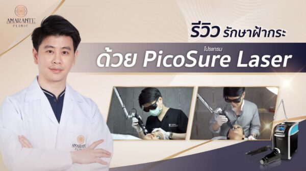 รักษาฝ้ากระ ด้วย Picosure laser