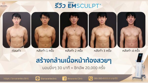 emsculpt