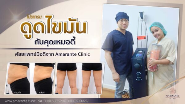 ดูดไขมัน