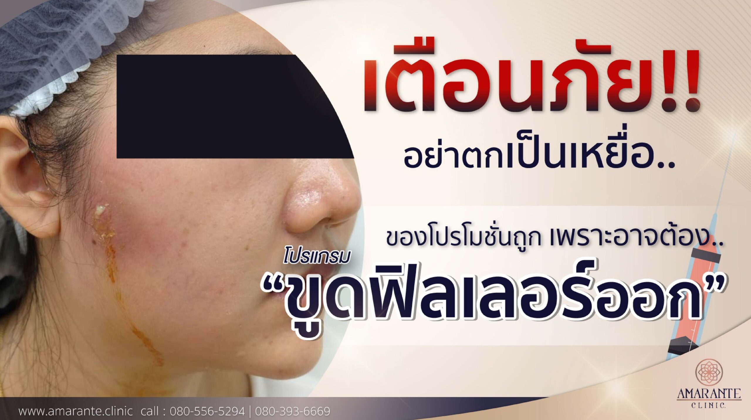 ขูดฟิลเลอร์ อันตรายไหม