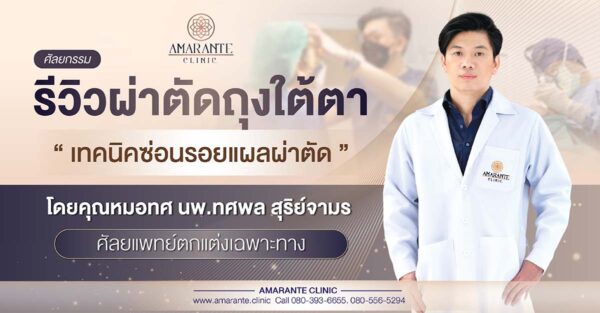 รีวิว ผ่าตัดถุงใต้ตา ,โดยคุณหมอทศ