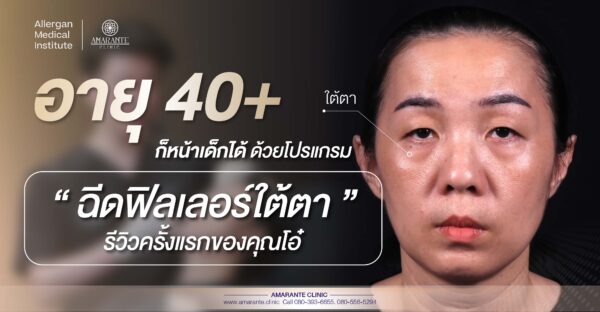 โปรแกรม ฉีดฟิลเลอร์ใต้ตา