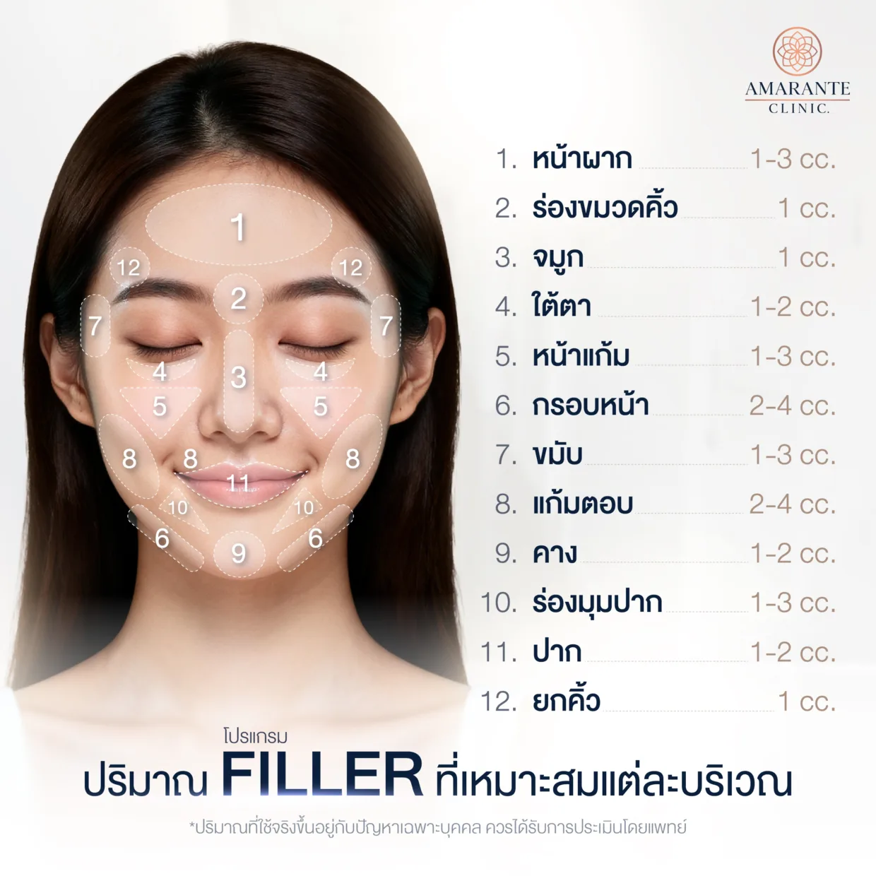 ฉีด filler แต่ละบริเวณใช้กี่ CC