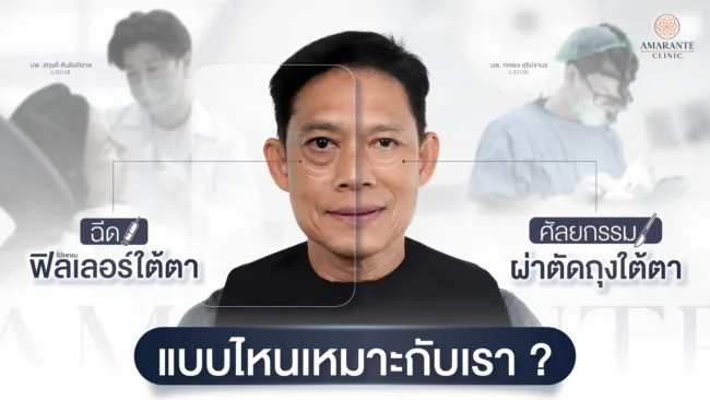 ศัลยกรรมผ่าตัดถุงใต้ตา VS ฉีดฟิลเลอร์ใต้ตา แบบไหนเหมาะกับเรา