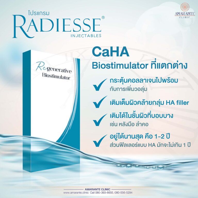 เรเดียสซ์ CaHA Biostimulator ที่แตกต่างกัน