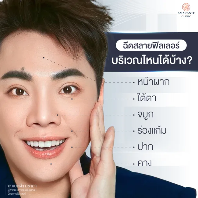 ฉีดสลายฟิลเลอร์บริเวณไหนได้บ้าง?