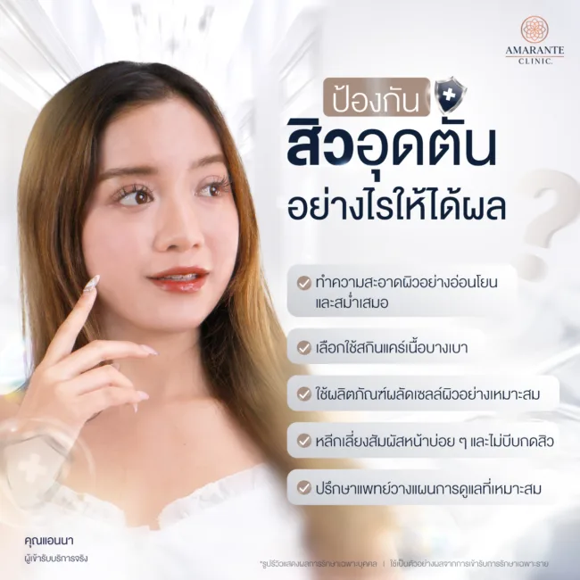 ป้องกันสิวอุดตันอย่างไรให้ได้ผล