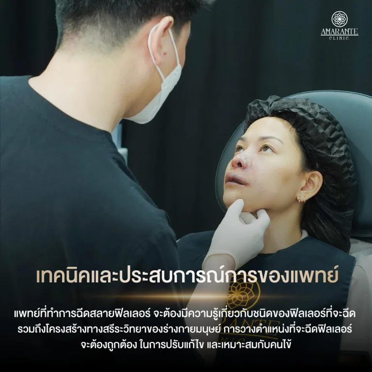 ทีมแพทย์ฉีดสลายฟิลเลอร์ เทคนิคและประสบการณ์