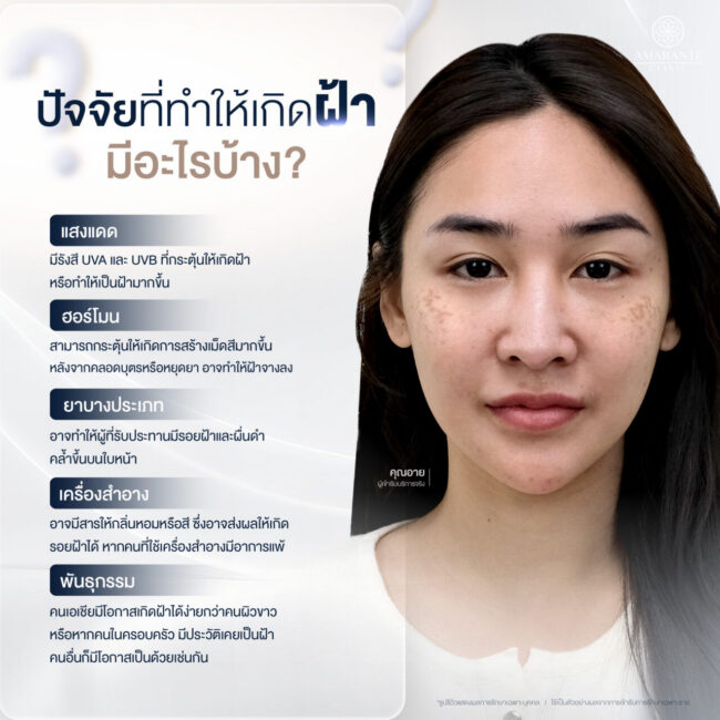 สาเหตุที่ทำให้เกิดฝ้า