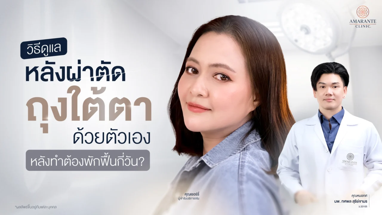 วิธีดูแลหลังผ่าตัดถุงใต้ตาด้วยตัวเอง หลังทำต้องพักฟื้นกี่วัน?