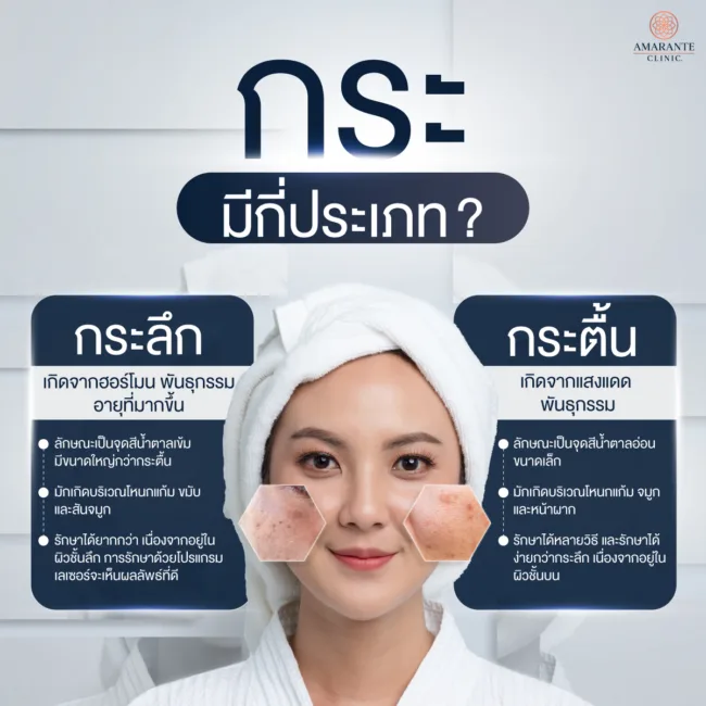 กระมีกี่ประเภท อะไรบ้าง