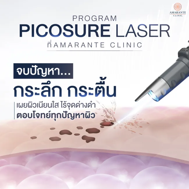 รักษากระ ด้วยโปรแกรม Picosure Laser ที่ Amarante Clinic