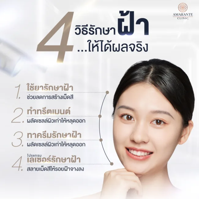 วิธีรักษาฝ้า