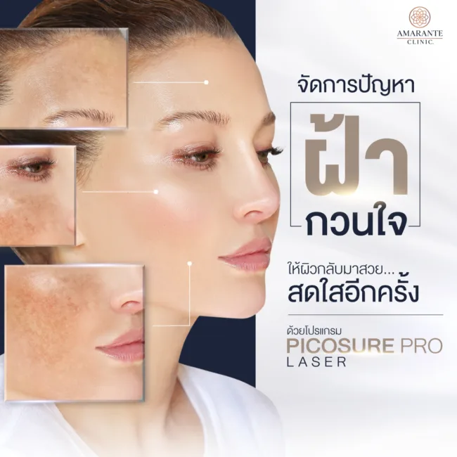 โปรแกรมรักษาฝ้า