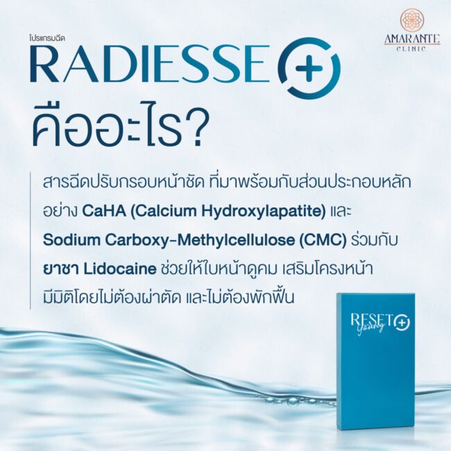 ภาพ infographic Radiesse Plus คืออะไร