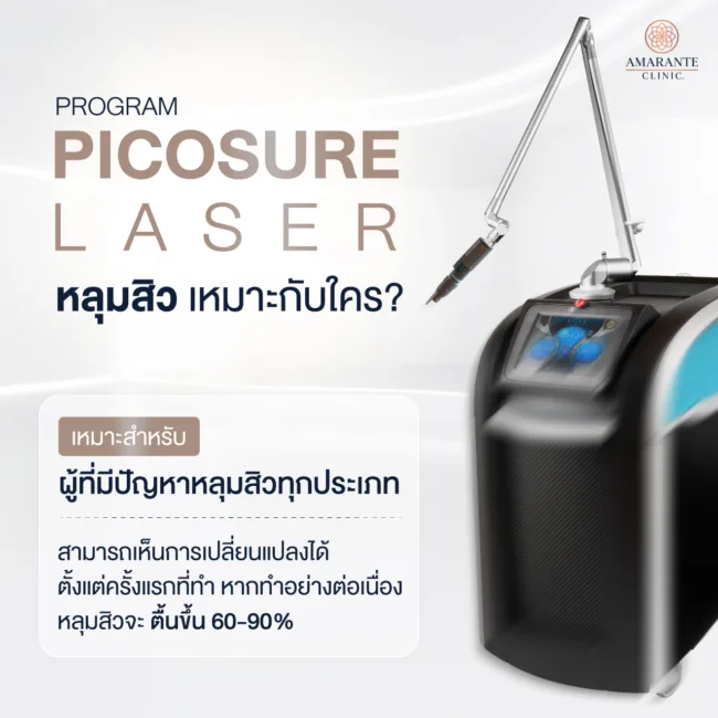 Pico Laser หลุมสิว เหมาะกับใคร