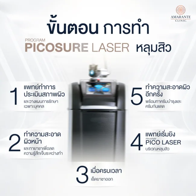 ขั้นตอนการ Pico Laser หลุมสิว