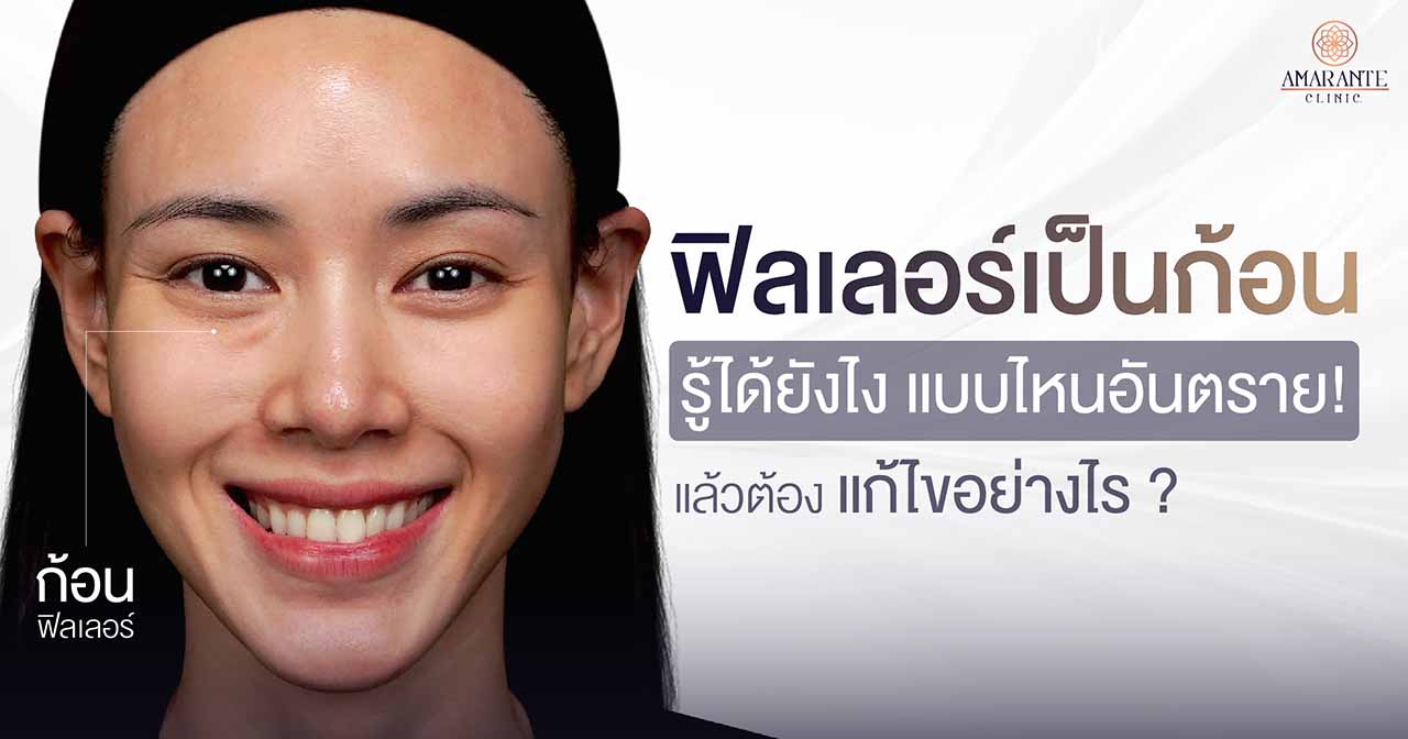ฟิลเลอร์เป็นก้อน ดูยังไง แบบไหนอันตราย แก้ไขอย่างไร