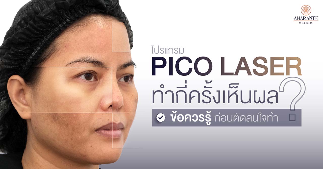 โปรแกรม Pico Laser ทำกี่ครั้งเห็นผล รวมข้อควรรู้ก่อนตัดสินใจทำ