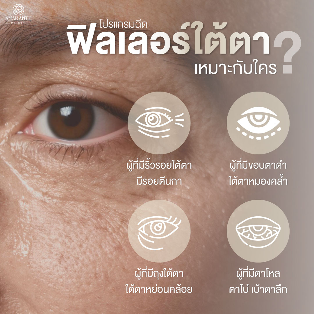 ฟิลเลอร์ใต้ตาช่วยอะไร เหมาะกับใครบ้าง