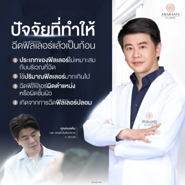 ปัจจัยที่ทำให้ฉีดฟิลเลอร์แล้วเป็นก้อน