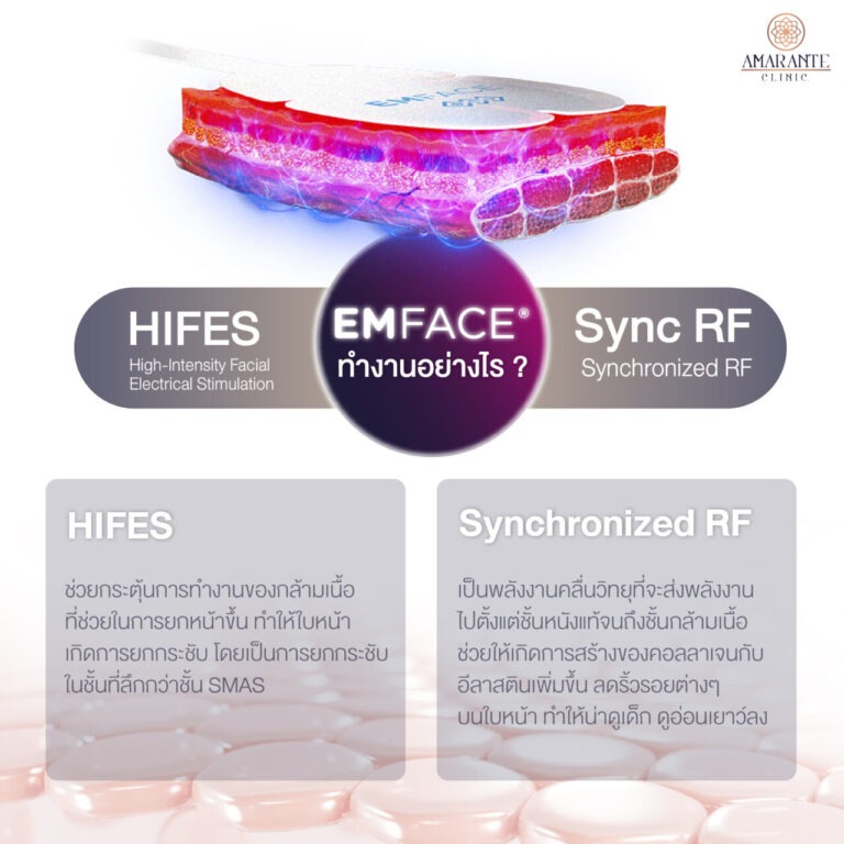 EMFACE-ทำงานอย่างไร