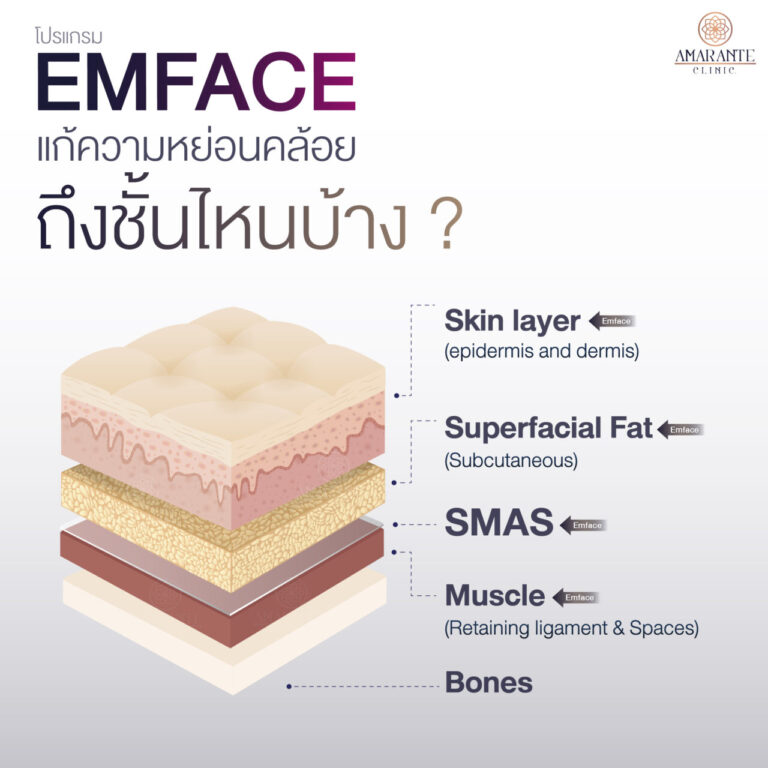 EMFACE-แก้ความหย่อนคล้อย