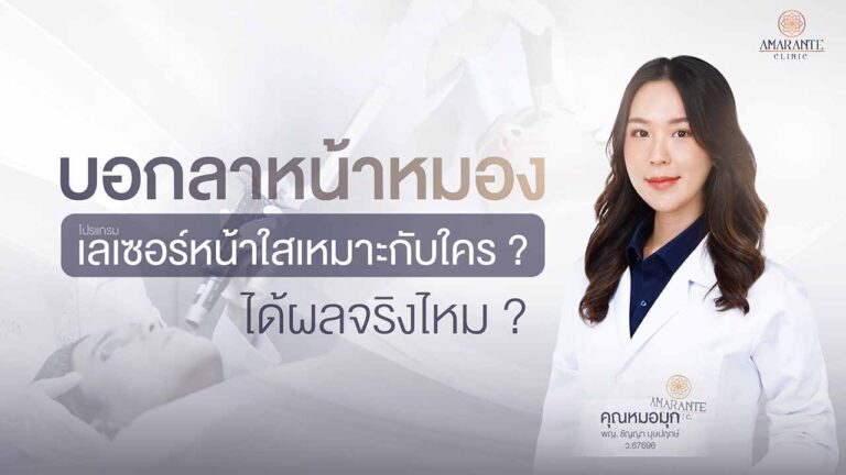 บอกลาหน้าหมอง โปรแกรมเลเซอร์หน้าใส เหมาะกับใคร ได้ผลจริงไหม