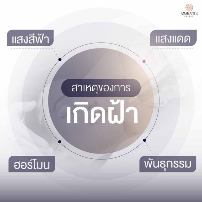 ฝ้ามีสาเหตุเกิดจากอะไร