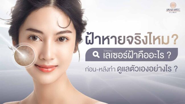 ฝ้าหายจริงไหม เลเซอร์ฝ้าคืออะไร ก่อน-หลังทำ ดูแลตัวเองอย่างไร